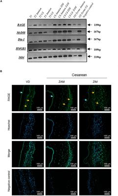 Occurrence of a RAGE-Mediated Inflammatory Response in Human Fetal Membranes